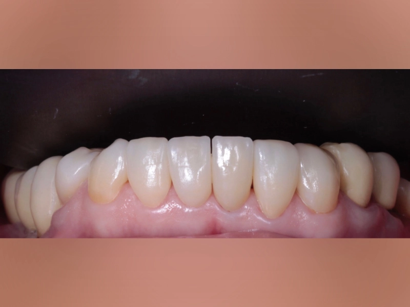 Clínica Dental Alameda Doctores Baima