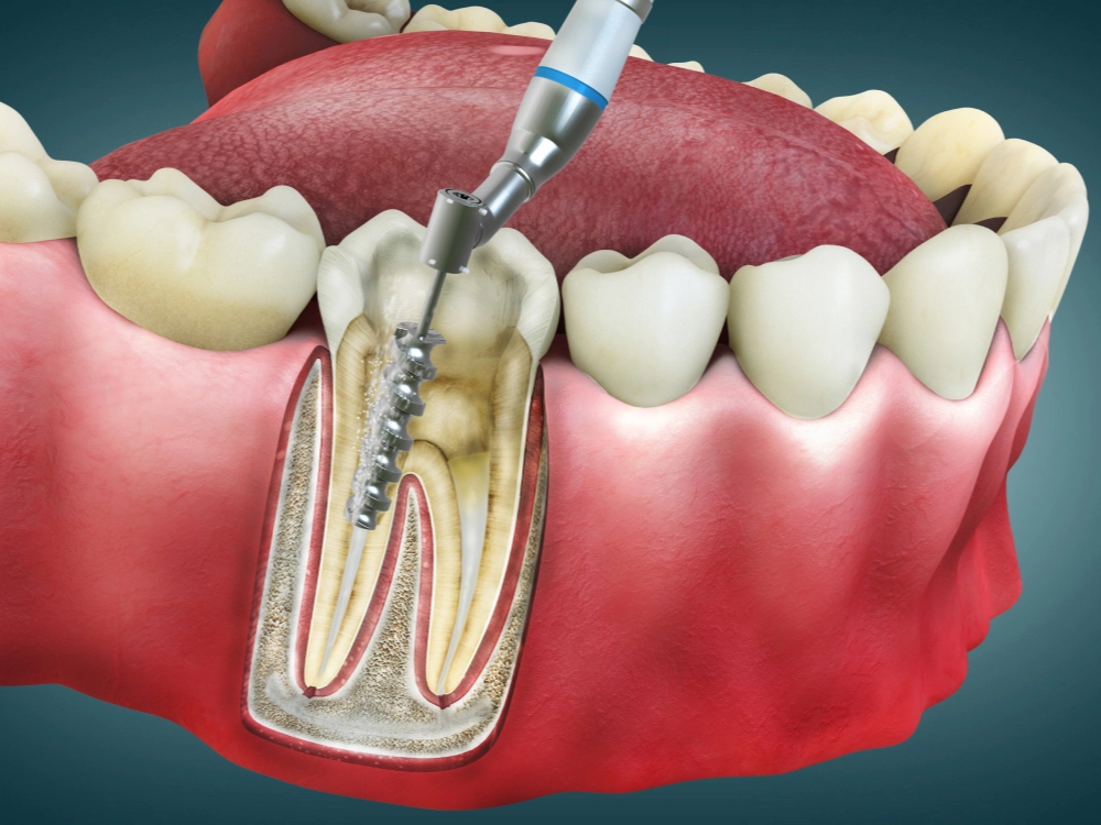 Odontología Conservadora