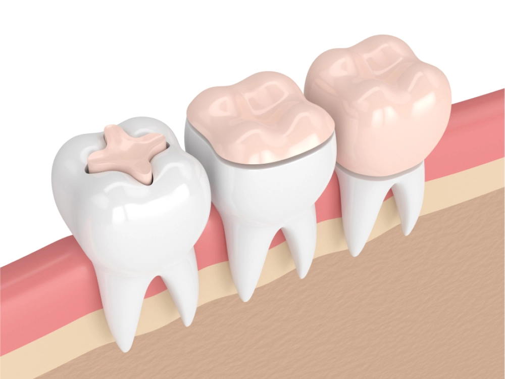 Odontología Conservadora