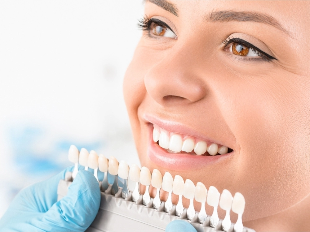 Fotografía de un tratamiento de estética dental