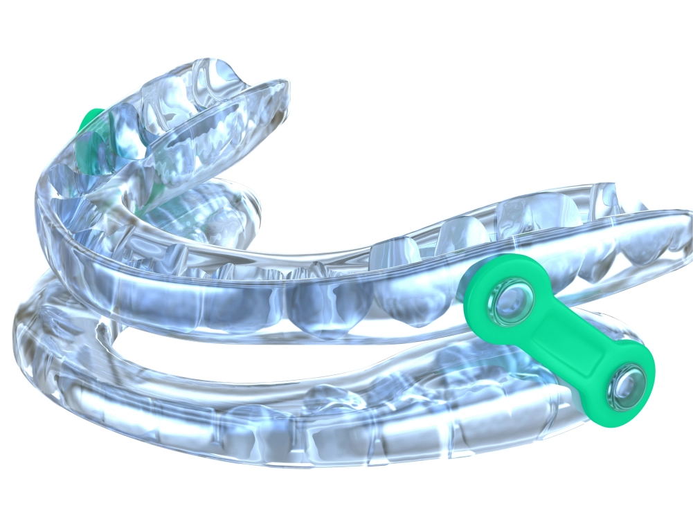 Dispositivo de Avance Mandibular (DAM)