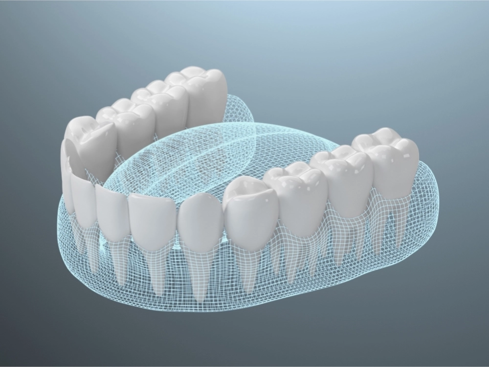 Fotografía de un tratamiento de estética dental